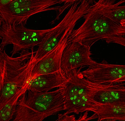 Image showing nucleolar bodies, with F-actin (red) and nucleolin (green), in human breast cancer cells (MDA-MB-231) cultured on soft (0.5 kPa) hydrogels. This study demonstrates changes in nucleolar composition in cells due to their tumorigenic potential and environmental cues. The image was acquired on a laser-scanning confocal microscope (ZEISS LSM 880) using a 63X objective. (Image: Florence Flick Jaecker, Department of Mechanical Engineering & Materials Science, Washington University in St. Louis)