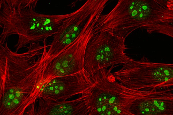 Image showing nucleolar bodies, with F-actin (red) and nucleolin (green), in human breast cancer cells (MDA-MB-231) cultured on soft (0.5 kPa) hydrogels. This study demonstrates changes in nucleolar composition in cells due to their tumorigenic potential and environmental cues. The image was acquired on a laser-scanning confocal microscope (ZEISS LSM 880) using a 63X objective. (Image: Florence Flick Jaecker, Department of Mechanical Engineering & Materials Science, Washington University in St. Louis)