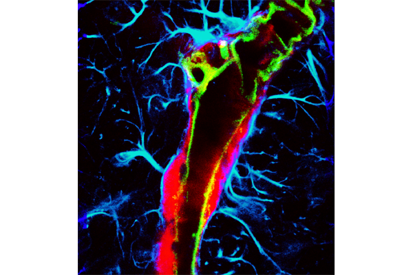 The image shows a microscopic image revealing the enhanced glymphatic transport of an intranasally delivered tracer (red), achieved using ultrasound combined with microbubbles. (Credit: Chen lab)  