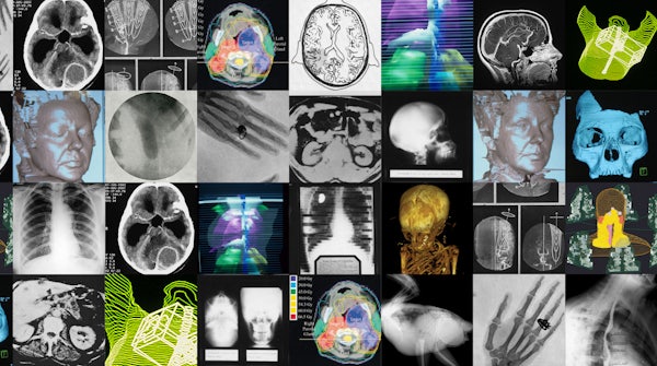 (Images courtesy of Mallinckrodt Institute of Radiology)