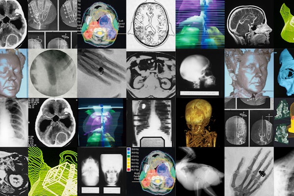 (Images courtesy of Mallinckrodt Institute of Radiology)