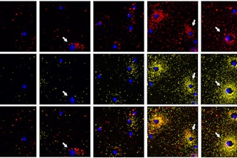 FluoroDOT assay images of dendritic cells secreting protein 1 (TNFa, shown in red) and protein 2 (IL-6, shown in yellow) at different time points (from left to right: Unstimulated, stimulated for 30 mins, 1 hour, 2 hours and 3 hours). The nuclei of the cell are shown in blue. The white arrows highlight the cells which are either secreting only one protein or different amounts of the two proteins and different time points. (Singamaneni lab)