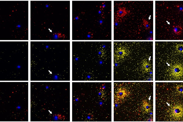 FluoroDOT assay images of dendritic cells secreting protein 1 (TNFa, shown in red) and protein 2 (IL-6, shown in yellow) at different time points (from left to right: Unstimulated, stimulated for 30 mins, 1 hour, 2 hours and 3 hours). The nuclei of the cell are shown in blue. The white arrows highlight the cells which are either secreting only one protein or different amounts of the two proteins and different time points. (Singamaneni lab)