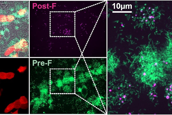 Pre-F and post-F containing RSV particles occur naturally in cell culture. (Credit: Vahey lab)