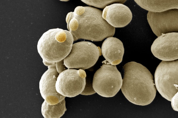 Michael Brent will use yeast, a single-cell organism that shares many functional components with human cells, to develop a quantitative model that can predict transcriptional responses to signals. Credit: Nano Imaging Lab, Swiss Nanoscience Institute, University of Basel