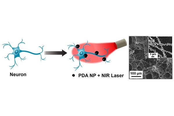 Schematic of polydopamine nanoparticle (PDA NP)-mediated photothermal stimulation of neurons. PDA nanoparticles localized on the neuron membrane (blue figure, left), modulates the neural activity through photothermal conversion of NIR light (red image, center).  On right: Scanning electron microscopy (SEM) image of neurons on electrode (inset: higher magnification SEM).