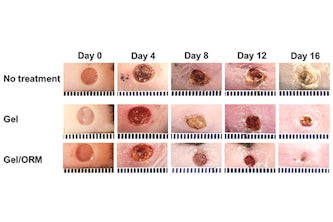 Representative images of the wounds treated with or without gel and oxygen-release microspheres for 16 days. 