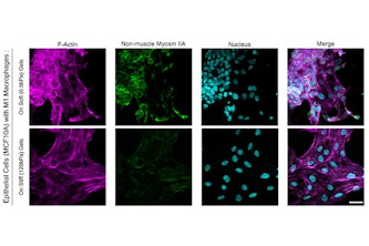 Epithelial cells display increased clustering in the presence of proinflammatory macrophages in soft environments (top row) compared with stiff environments (bottom row). (Credit: Pathak lab)