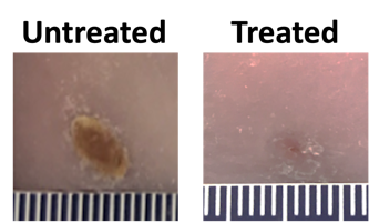 In early experiments, Jianjun Guan and his team found that after applying a single dose of their wound dressing into wounds in young diabetic mice, the wounds completely closed at day 14. Wounds that were treated only with the hydrogel or were untreated were reduced to roughly half of their original size. (Guan lab)
