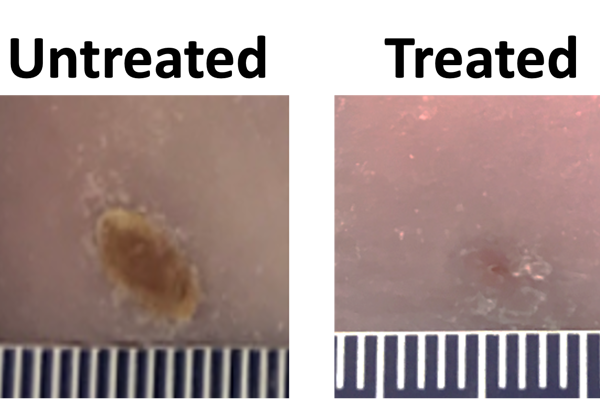 In early experiments, Jianjun Guan and his team found that after applying a single dose of their wound dressing into wounds in young diabetic mice, the wounds completely closed at day 14. Wounds that were treated only with the hydrogel or were untreated were reduced to roughly half of their original size. (Guan lab)