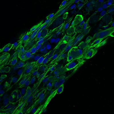A micro-heart muscle from cells with a normal genotype. It is stained for MYBPC3 (Myosin Binding Protein C). Image credit: Jingxuan Guo (Huebsch Lab MEMS doctoral student and American Heart Association Predoctoral Fellow).