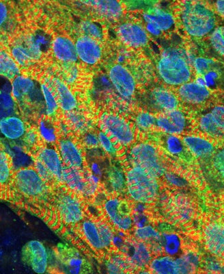 Confocal cross section of micro-engineered heart tissue (µEHT) derived from human induced pluripotent stem cells. Heart muscle cells (cardiomyocytes) are stained for sarcomere proteins alpha-actinin-2 (in red) and myosin binding protein-C (in green). The nuclei (in blue) provide insight into cell distribution, highlighting the interconnection of cells within the aligned tissue. (Image: Ghiska Ramahdita, Huebsch lab)