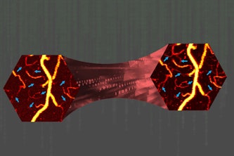 On the left is a noisy, low-fluence photoacoustic microscopy image of blood vessels. By using machine learning, represented as a bridge, the team was able to create a denoised image, pictured on the right. (Courtesy: Hu lab)