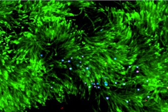 Mike Vahey’s lab is using cilia (in green) to study how influenza virus particles (in blue and red) spread through their environment. (Credit: Vahey lab)