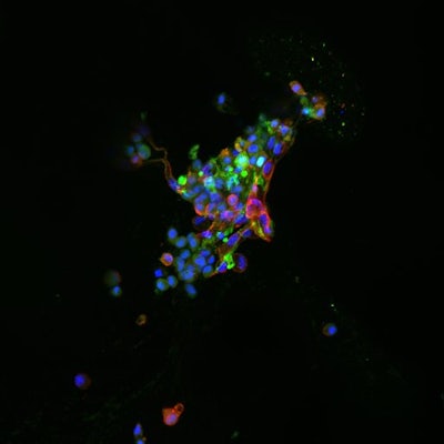 An immunofluorescence image of the cells delivered to intervertebral discs. (Photo credit: Setton Lab)