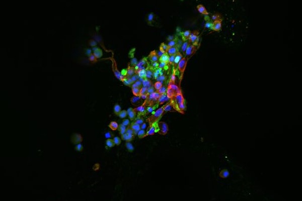 An immunofluorescence image of the cells delivered to intervertebral discs. (Photo credit: Setton Lab)