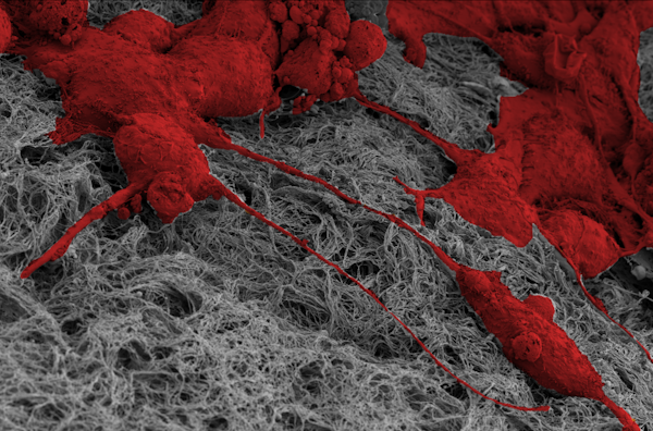 Scanning electron microscopy image of MCF10A human mammary epithelial cells (in red) with mechanical memory of past stiff environments pulling on collagen fibers (in gray) to install matrix memory, which helps propel future cell invasion. Image taken at the Washington University Center for Cellular Imaging (WUCCI). (Credit: José Almeida, Pathak lab)