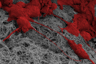 Scanning electron microscopy image of MCF10A human mammary epithelial cells (in red) with mechanical memory of past stiff environments pulling on collagen fibers (in gray) to install matrix memory, which helps propel future cell invasion. Image taken at the Washington University Center for Cellular Imaging (WUCCI). (Credit: José Almeida, Pathak lab)