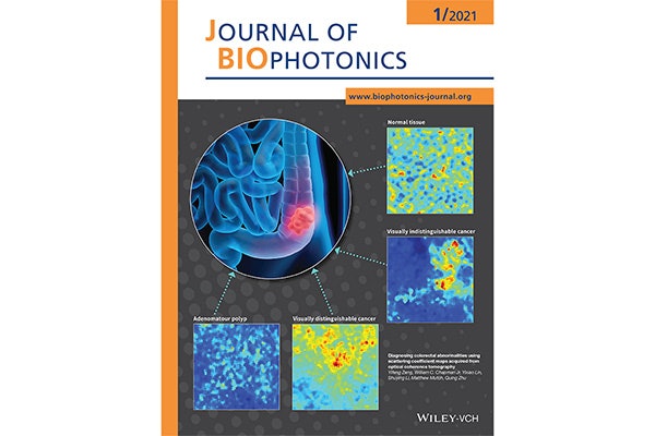 In results published in the January 2021 Journal of Biophotonics, Yifeng Zeng and a team of researchers found that OCT showed differences in the textures and patterns of normal and abnormal tissue, which are difficult to determine using traditional visual inspection.
